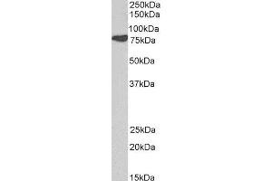 ABIN2561960 (0. (Cortactin anticorps  (N-Term))