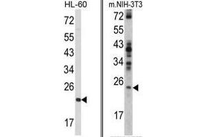 (LEFT) Western blot analysis of RAN Antibody (N-term) in HL-60 cell line lysates (35ug/lane). (RAN anticorps  (N-Term))