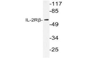 Western blot (WB) analysis of IL-2Rbeta antibody in extracts from RAW264. (IL2 Receptor beta anticorps)