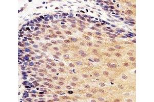 IHC analysis of FFPE human esophagus section using anti-p53 antibody; Ab was diluted at 1:100.