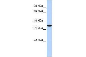 WB Suggested Anti-MARCH1 Antibody Titration:  0. (MARCH1 anticorps  (N-Term))