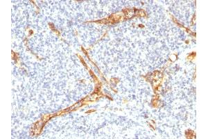 Formalin-fixed, paraffin-embedded human Tonsil stained with CD34 Recombinant Rabbit Monoclonal Antibody (HPCA1/2598R).