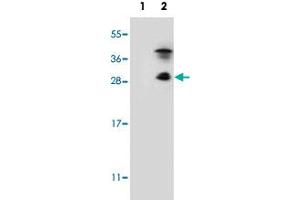Western blot analysis of KLK7 (arrow) using KLK7 polyclonal antibody .