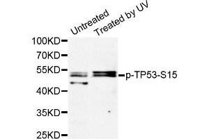 Western Blotting (WB) image for anti-Tumor Protein P53 (TP53) (pSer15) antibody (ABIN1870674) (p53 anticorps  (pSer15))