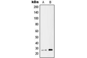Western blot analysis of RAB26 expression in MCF7 (A), U87MG (B) whole cell lysates. (RAB26 anticorps  (C-Term))