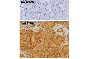Immunohistochemistry (IHC) image for anti-STIP1 Homology and U-Box Containing Protein 1 (STUB1) antibody (ABIN6254206) (STUB1 anticorps)