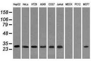 Image no. 5 for anti-Replication Protein A2, 32kDa (RPA2) antibody (ABIN1500733)