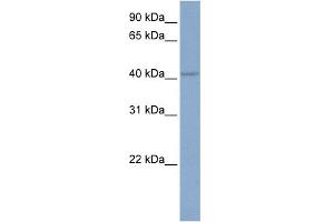 WB Suggested Anti-KCNN4 Antibody Titration:  0. (KCNN4 anticorps  (C-Term))