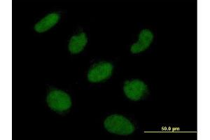Immunofluorescence of  purified  MaxPab antibody to RNF113A on HeLa cell. (RNF113A anticorps  (AA 1-343))