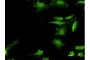 Immunofluorescence of monoclonal antibody to STIP1 on HeLa cell. (STIP1 anticorps  (AA 1-543))