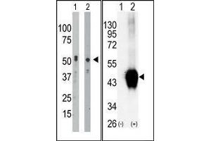 (LEFT)The anti-BCKDK Pab is used in Western blot to detect BCKDK in mouse intestine tissue lysate (Lane 1) and Hela cell lysate (Lane 2). (BCKDK anticorps  (C-Term))
