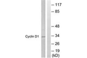 Western blot analysis of extracts from Jurkat cells, treated with EGF 200ng/ml 30', using Cyclin D1 (Ab-286) Antibody. (Cyclin D1 anticorps  (AA 246-295))