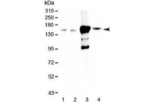 Western blot testing of 1) rat kidney, 2) mouse kidney, 3) human 293T and 4) human HK-2 lysate with Periaxin antibody at 0. (Periaxin anticorps)