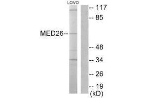 Western blot analysis of extracts from LOVO cells, using MED26 antibody. (MED26 anticorps  (N-Term))