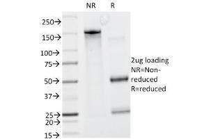 SDS-PAGE Analysis Purified Caldesmon Mouse Monoclonal Antibody (CALD1/820). (Caldesmon anticorps)