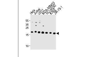 ICT1 Antibody (C-term) (ABIN1881444 and ABIN2843293) western blot analysis in Hela,Jurkat,,MDA-M,NCI-,K562,ZR-75-1 cell line lysates (35 μg/lane). (ICT1 anticorps  (C-Term))