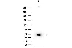 Western blot analysis of lysates from COLO205 cells, using EMX1 Antibody at 1/1000 dilution.