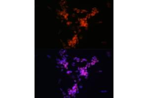 Immunofluorescence analysis of SH-SY5Y cells using CHAT Rabbit mAb (ABIN7266343) at dilution of 1:100 (40x lens). (Choline Acetyltransferase anticorps)