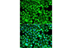 Immunofluorescence analysis of A549 cells using PSMB8 antibody.