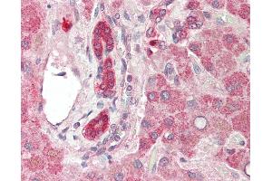 Human Liver: Formalin-Fixed, Paraffin-Embedded (FFPE).