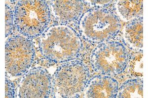 ABIN6264219 and ABIN6279663 at 1/100 staining Mouse testis tissue by IHC-P.