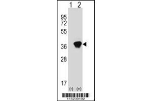 Western blot analysis of AKR1A1 using rabbit polyclonal AKR1A1 Antibody using 293 cell lysates (2 ug/lane) either nontransfected (Lane 1) or transiently transfected (Lane 2) with the AKR1A1 gene. (AKR1A1 anticorps  (C-Term))
