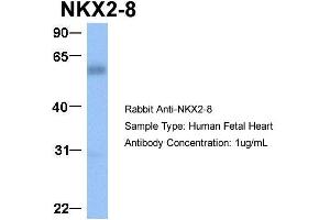 Host:  Rabbit  Target Name:  NKX2-8  Sample Type:  Human Fetal Heart  Antibody Dilution:  1. (NKX2-8 anticorps  (C-Term))