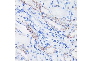 Immunohistochemistry of paraffin-embedded Rat kidney using EPN1 Rabbit pAb (ABIN7267000) at dilution of 1:100 (40x lens).