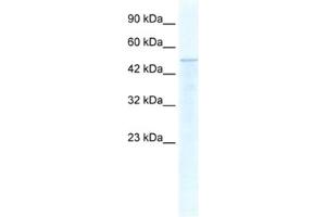 Western Blotting (WB) image for anti-Thyroid Hormone Receptor Interactor 10 (TRIP10) antibody (ABIN2460889) (TRIP10 anticorps)