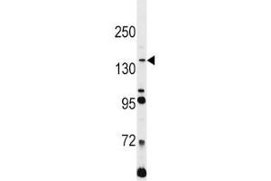 L1CAM antibody western blot analysis in Jurkat lysate.