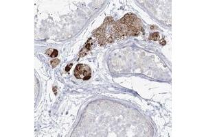 Immunohistochemical staining of human testis with ZNF843 polyclonal antibody  shows strong cytoplasmic positivity in Leydig cells. (ZNF843 anticorps)