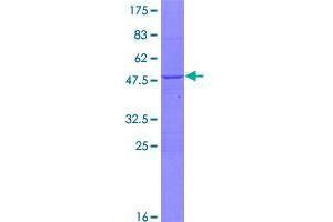 Image no. 1 for DnaJ (Hsp40) Homolog, Subfamily C, Member 2 (DNAJC2) (AA 1-167) protein (GST tag) (ABIN1351805)