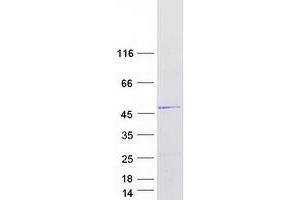 Validation with Western Blot