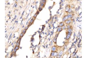 IHC analysis of PDE4DIP using anti-PDE4DIP antibody (ABIN7602691).