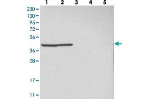 Western blot analysis of Lane 1: RT-4, Lane 2: U-251 MG, Lane 3: Human Plasma, Lane 4: Liver, Lane 5: Tonsil with MRPL37 polyclonal antibody .