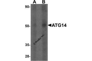 Western Blotting (WB) image for anti-ATG14 Autophagy Related 14 (ATG14) antibody (ABIN1077377) (ATG14 anticorps)