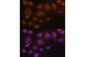 Immunofluorescence analysis of C6 cells using  Rabbit mAb (ABIN7265485) at dilution of 1:100 (40x lens). (ARF6 anticorps)