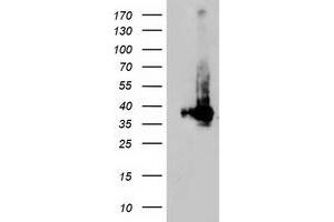 Western Blotting (WB) image for anti-Low Density Lipoprotein Receptor Adaptor Protein 1 (LDLRAP1) antibody (ABIN1496691) (LDLRAP1 anticorps)