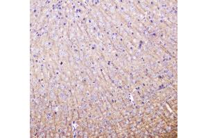 IHC analysis of MAP1LC3A using anti-MAP1LC3A antibody .