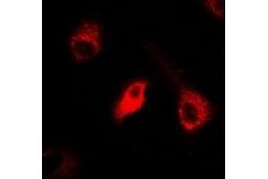 Immunofluorescent analysis of IDE staining in A549 cells.