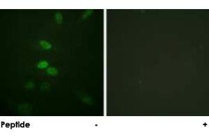 Immunofluorescence analysis of HeLa cells, using CDC25B polyclonal antibody . (CDC25B anticorps)