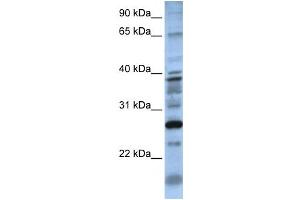 Western Blotting (WB) image for anti-Dolichyl Pyrophosphate Phosphatase 1 (DOLPP1) antibody (ABIN2459296) (DOLPP1 anticorps)
