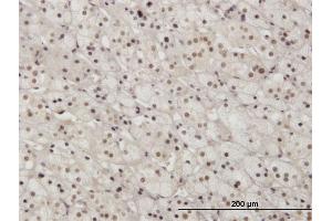 Immunoperoxidase of monoclonal antibody to PAX2 on formalin-fixed paraffin-embedded human adrenal gland.