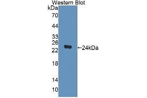 Western blot analysis of the recombinant protein. (DPEP2 anticorps  (AA 303-486))
