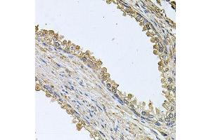 Immunohistochemistry of paraffin-embedded human prostate using MEMO1 antibody (ABIN5995855) at dilution of 1/100 (40x lens). (MEMO1 anticorps)