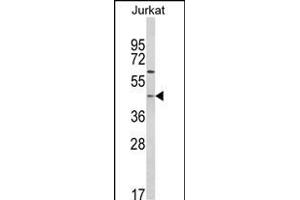 Western blot analysis of PTAR1 Antibody (Center) (ABIN652563 and ABIN2842379) in Jurkat cell line lysates (35 μg/lane). (PTAR1 anticorps  (AA 60-89))