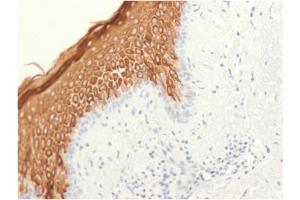 Formalin-fixed, paraffin-embedded human skin stained with Cytokeratin 10 Rabbit Recombinant Monoclonal Antibody (KRT10/1948R). (Recombinant Keratin 10 anticorps)