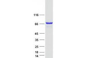 Validation with Western Blot