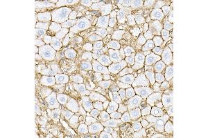 Immunohistochemistry of paraffin-embedded mouse brain using RPGR Rabbit pAb (ABIN3015609, ABIN3015610, ABIN3015611, ABIN1682567 and ABIN6218971) at dilution of 1:50 (40x lens). (RPGR anticorps  (AA 1-260))