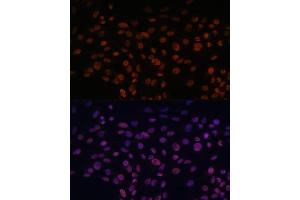 Immunofluorescence analysis of C6 cells using CHD4 antibody (ABIN6127308, ABIN6138512, ABIN6138513 and ABIN6215263) at dilution of 1:100. (CHD4 anticorps  (AA 1520-1690))